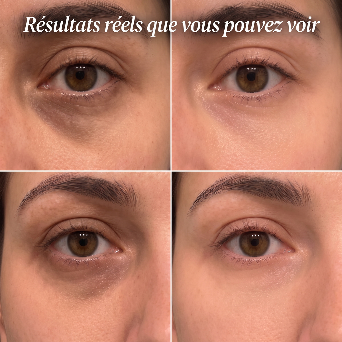 Stick Repulpant Bio-Collagène & PDRN